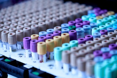 Small round picture of small lab vials in a holder.